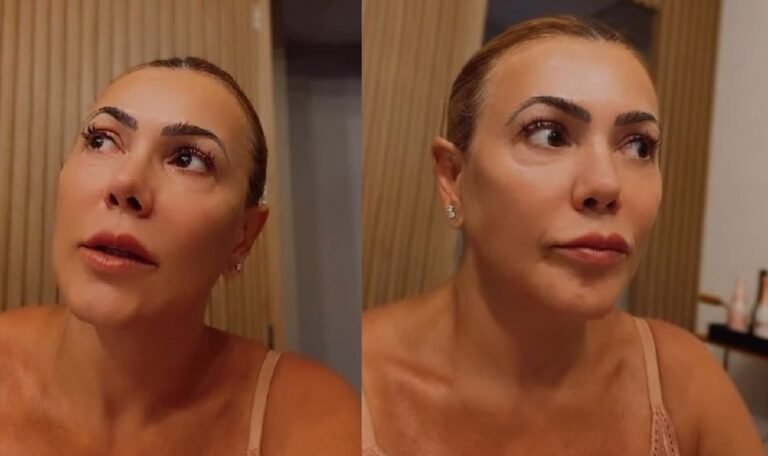 fabiana teixeira cisto cerebro