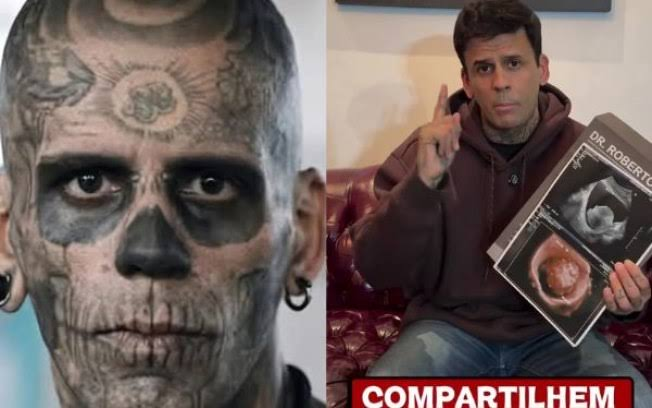 Influenciador conhecido como “homem mais tatuado do Brasil” será submetido a cirurgia para retirar tumor na bexiga
