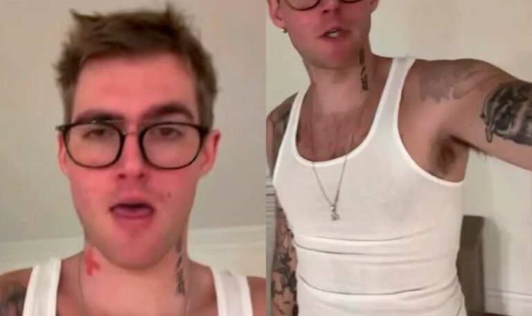 Vídeo mostra Presley Gerber horas antes de morrer em clínica de reabilitação 46 Vídeo mostra Presley Gerber horas antes de morrer em clínica de reabilitação