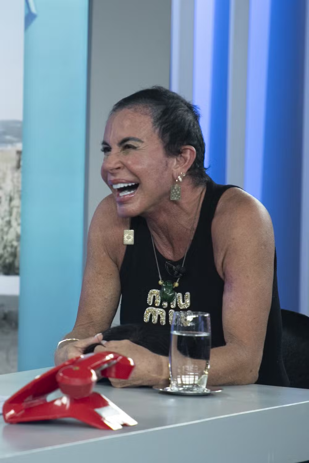 Gretchen mostra evolução de implante capilar após diagnóstico de alopecia