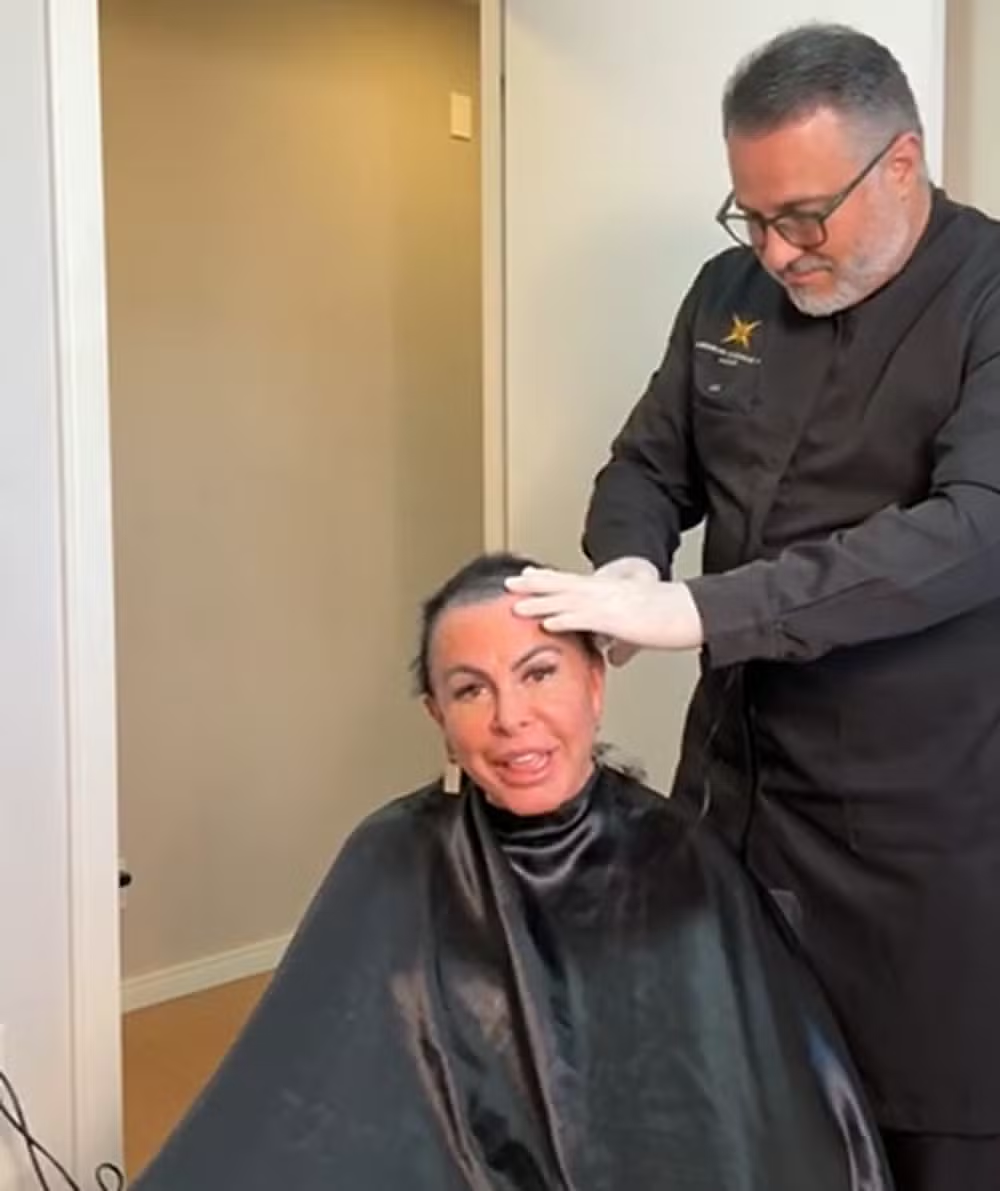 Gretchen mostra evolução de implante capilar após diagnóstico de alopecia