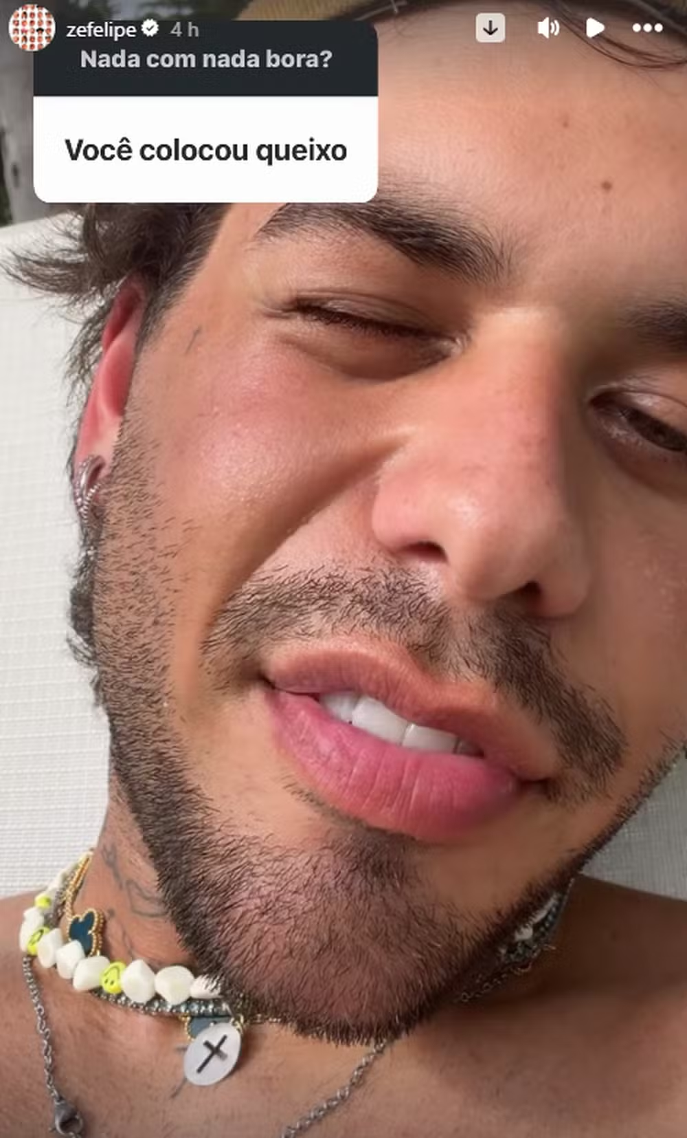 Zé Felipe revela ter perdido 5 kg e diz se fez procedimento estético no rosto