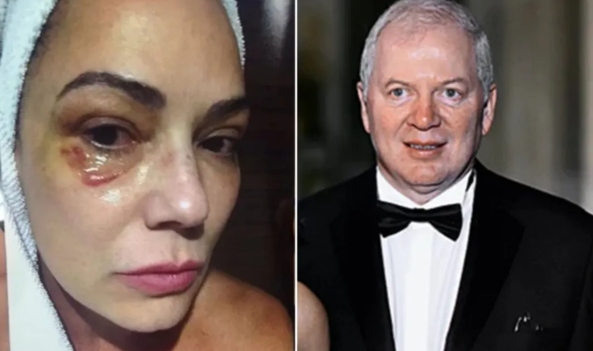 Lírio Parisotto é condenado a pagar indenização a Luiza Brunet por agressão 47 Lírio Parisotto é condenado a pagar indenização a Luiza Brunet por agressão